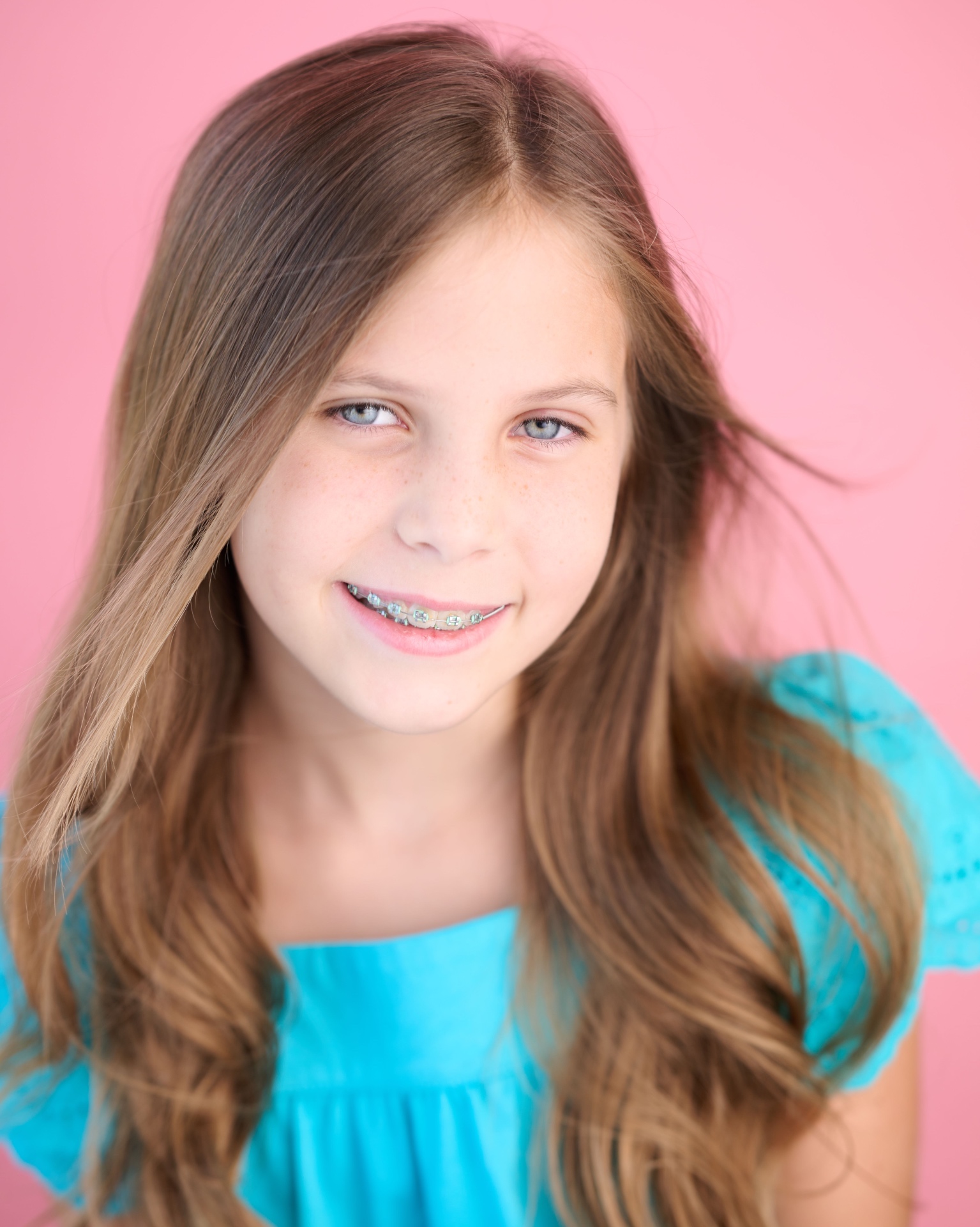 Remington Burt photo 4